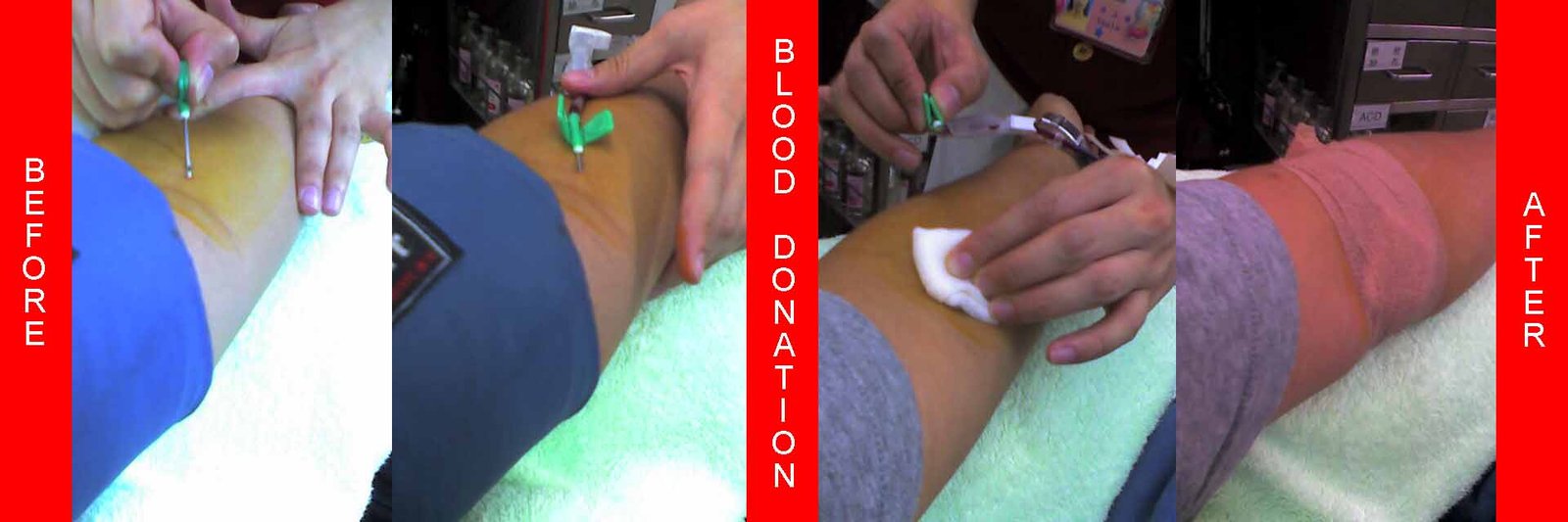 Arm connected to a blood donation needle during blood collection