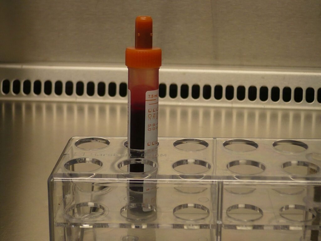 Blood sample tube used for laboratory testing