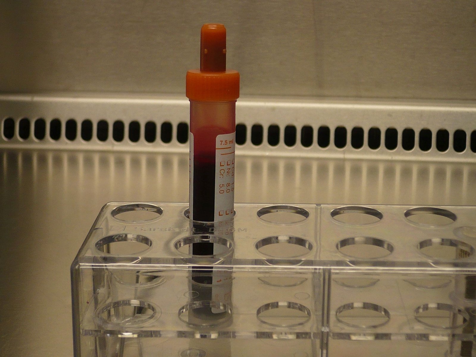 Blood sample tube used for laboratory testing